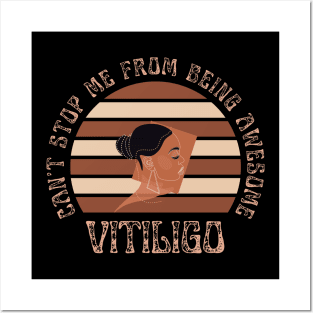 Vitiligo Can't Stop Me From Being Awesome Sunset Background Female Model Posters and Art